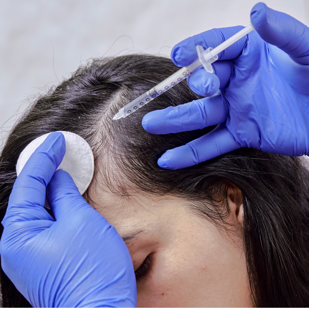 Mesotherapy